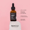 SkinTra - Comedo-killer - Serums ar inkapsulētu salicilskābi 2% - 30ml