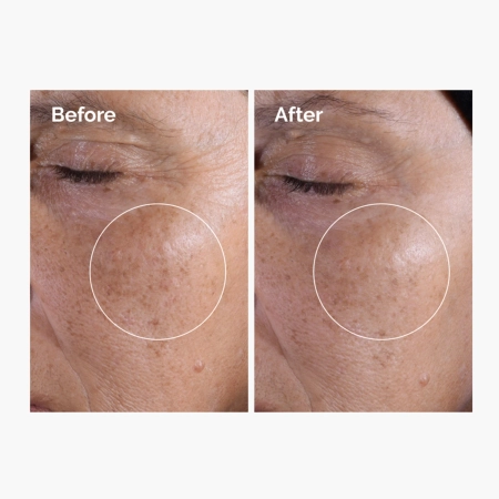 The Ordinary - Glycolic Acid 7% Exfoliating Toner - Eksfoliējošs Toniks ar 7% Glikolskābi - 240ml