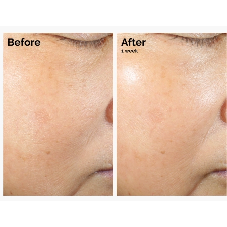 The Ordinary - Rice Lipids + Ectoin Microemulsion - Mikroemulsija ar Rīsu Lipīdiem un Ektoīnu - 120ml