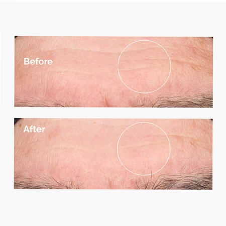 The Ordinary - Hyaluronic Acid 2% + B5 - Mitrinošs Serums ar 2% Hialuronskābi un B5 Vitamīnu- 60ml