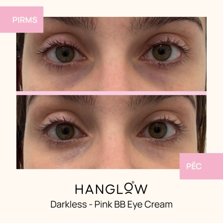 HanGlow - Darkless - Pink BB Eye Cream - Krēms-Korektors Ādai Zem Acīm - 15ml