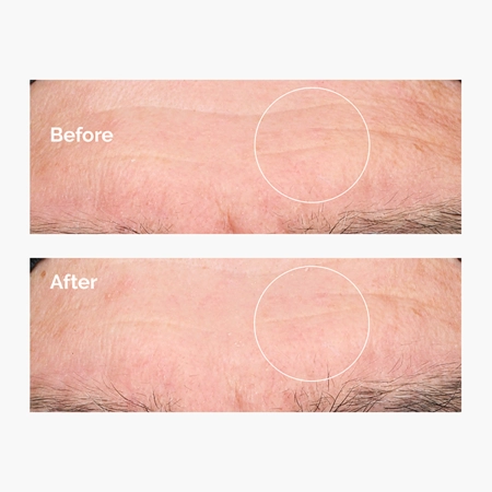 The Ordinary - Hyaluronic Acid 2% + B5 - Mitrinošs Serums ar 2% Hialuronskābi un B5 Vitamīnu - 30ml